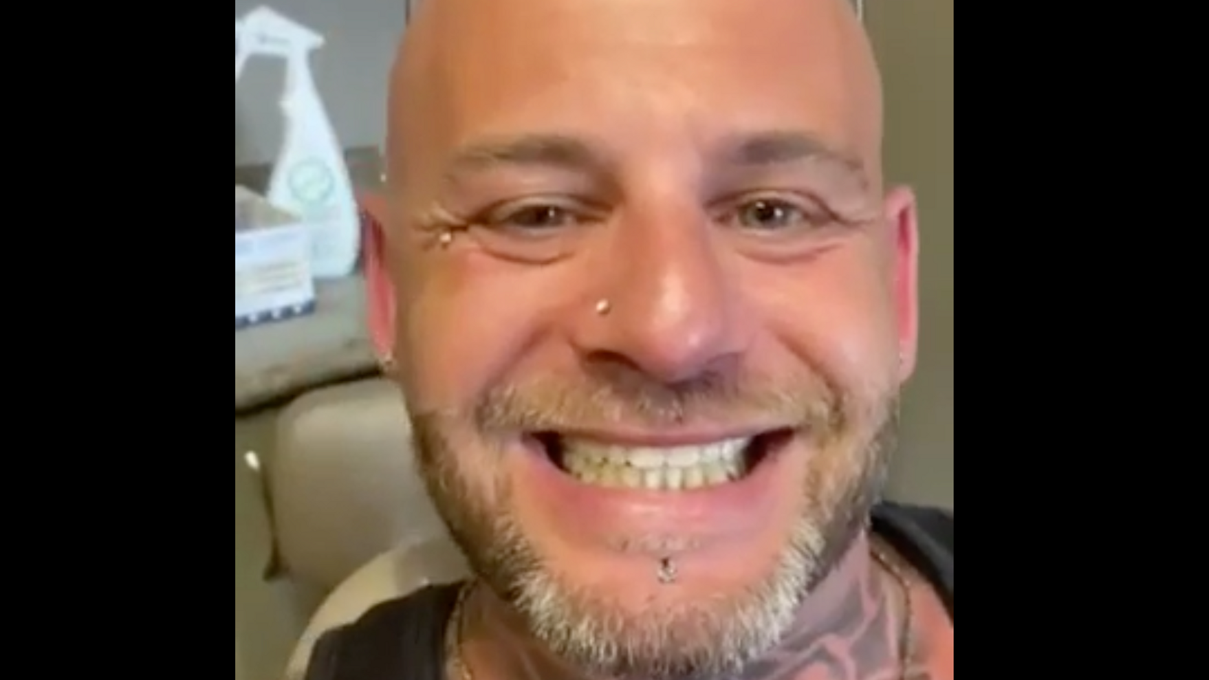 Denture Review
